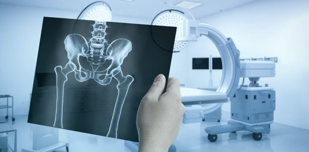X-Rays